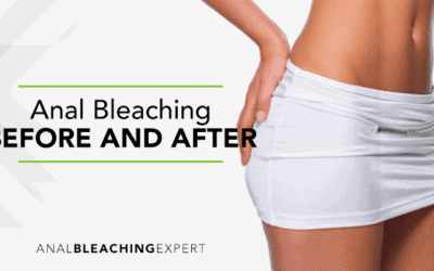 Anal Bleaching – Before and After
