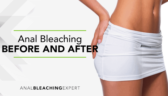 Anal bleaching before and after photos