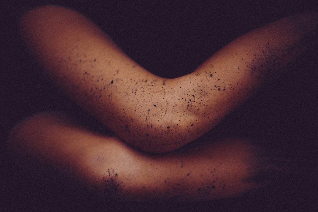 does anal bleaching hurt your skin